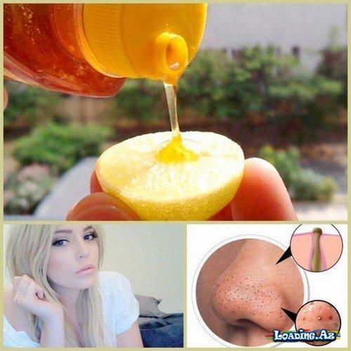 Limon və balla qara nöqtələrə və sızanaqlara son - Take.Az
